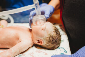 Richmond, Virginia birth photographer, newborn baby with oxygen mask over her face